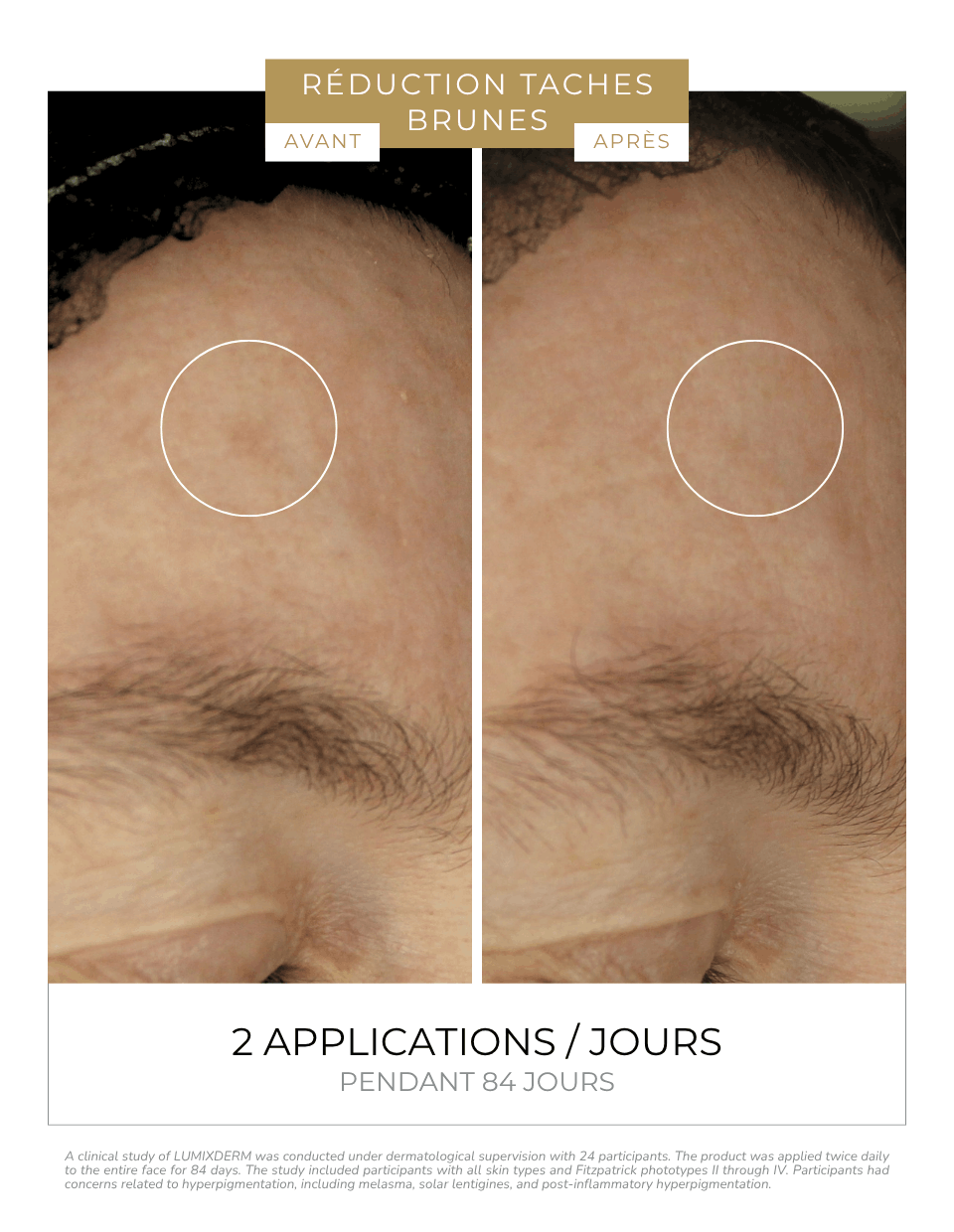 LUMIXDERME - WHITENING CREAM - DermEden - Laboratoires DermEden