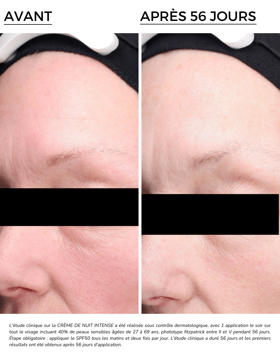 INTENSE NIGHT CREAM - DermEden INTENSE NIGHT CREAM - DermEden