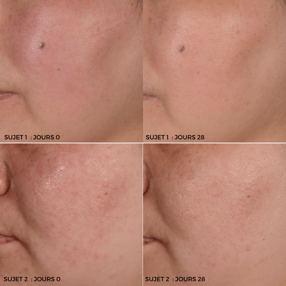 results mask